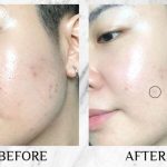سرم ضد لک کلینیک روشن کننده Clinique Even Better - تصویر 3
