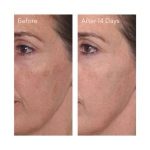 سرم ضد لک کلینیک روشن کننده Clinique Even Better - تصویر 4