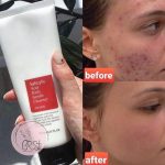 شوینده سالیسیلیک اسید کوزارکس Cosrx Salicylic Acid Daily Gentle Cleanser - تصویر 2
