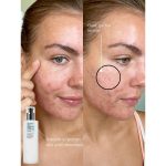 لوسیون مرطوب کننده فاقد چربی کوزارکس COSRX Oil-Free Ultra-Moisturizing Lotion - تصویر 2
