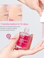 سرم ضد لک نیاسینامید 10% + ترانگزامیک 4% آنوا - تصویر 3