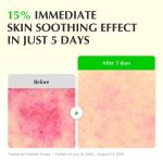 سرم آلوئه ورا و PDRN ترمیم و احیا اکوال بری EQQUALBERRY Aloe PDRN Calming Serum - تصویر 3