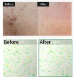 اسنس تقویت کننده و ترمیم کننده ریدل شات 100 وی تی کازمتیک - تصویر 2