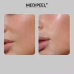 اسنس لیفتینگ و حجم دهنده 9 پپتاید مدی پیل - تصویر 4