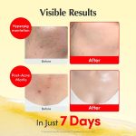 کرم ویتامین سی ضدلک و درخشان کننده اکوال بری EQQUALBERRY Vitamin Illuminating Cream - تصویر 4