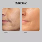 کرم حجم دهنده و ضد چروک 9 پپتاید مدی پیل - تصویر 3