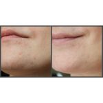 کرم آبرسان و روشن کننده با عصاره برنج آیم فرام - تصویر 7